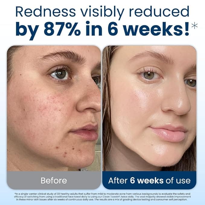 Vanilla Girl Makeup trend - Clean Skin Club Clean Towels XL Ultra Soft Disposable Face Towelette Face Towel Eczema Association Accepted product image showing the affordable Amazon dupe for achieving this makeup look