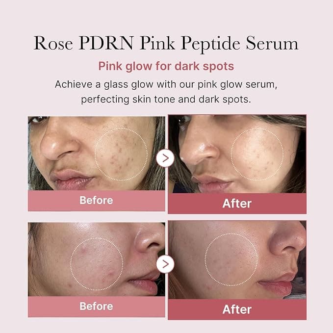 medicube PDRN Pink Peptide Serum, Pink glow serum, Peptide, Niacinamide, Hydrating & Moisturizing & Firming, Uneven Skin Tone, Korean Skincare | 1.01 fl.oz. (1.01 fl.oz., Rose PDRN (Vegan)) - Beauty & Cosmetics - Serum - Under $25